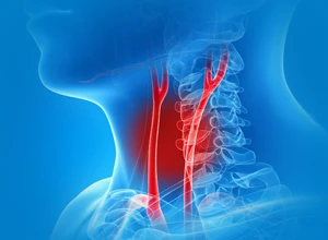 Дуплексное сканирование брахиоцефальных артерий с цветным допплеровским картированием кровотока