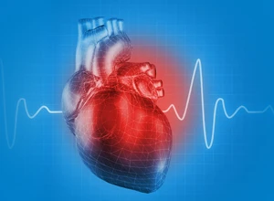 Регистрация ЭКГ