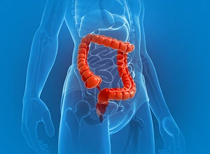 Колоноскопия под наркозом