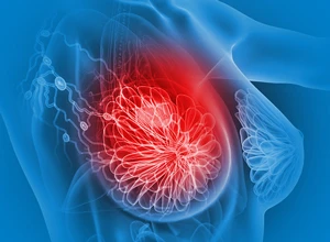 Ультразвуковое исследование (УЗИ) молочных желез