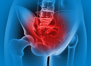 Ультразвуковое исследование (УЗИ) органов малого таза